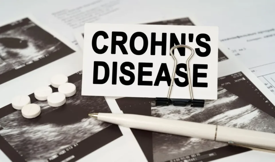 Σύλλογος Ατόμων με νόσο Crohn: Απογοήτευση και ανησυχία για την εξαίρεση της εξέτασης καλπροτεκτίνης από την ασφαλιστική αποζημίωση