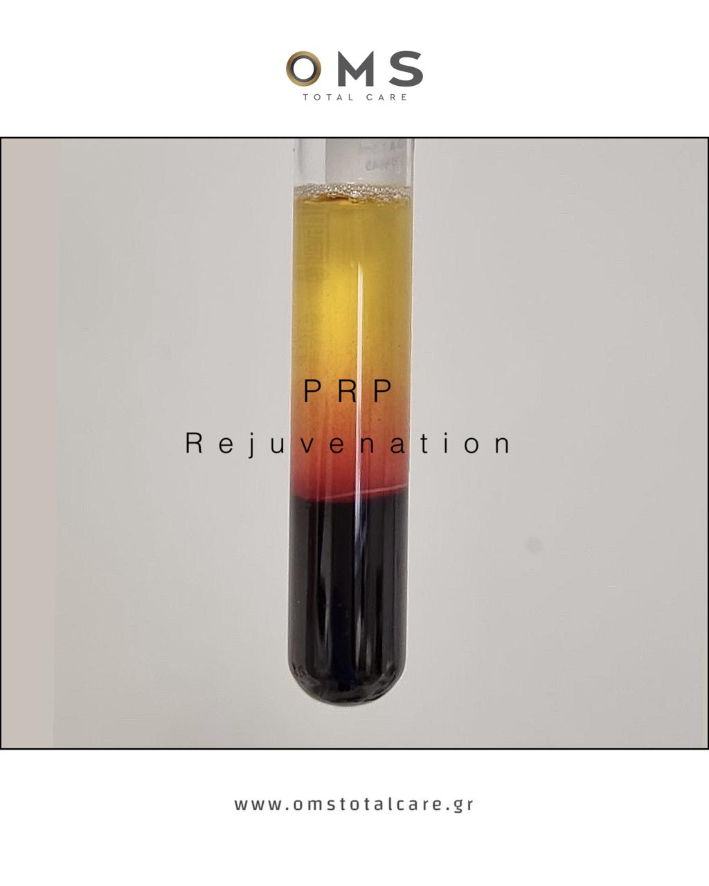 prp