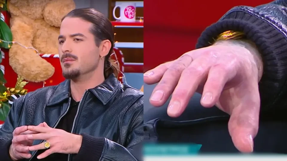Άρης Μουγκοπέτρος: Η συγκλονιστική εξομολόγηση για το ατύχημα, το πρόσθετο μέλος και την επιστροφή στη μουσική
