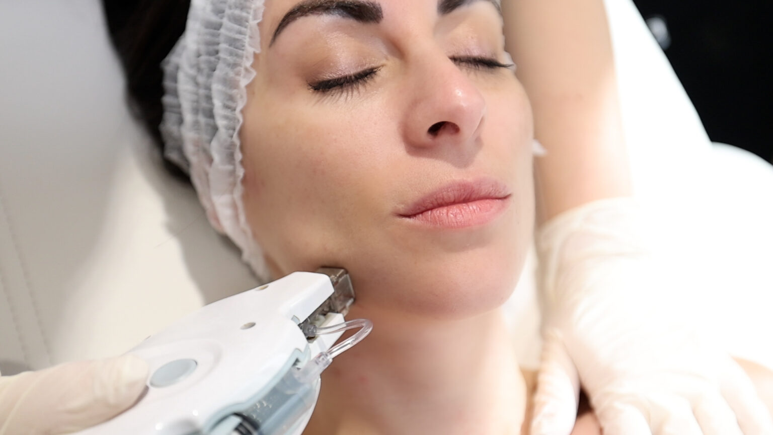 Μεσοθεραπεία beautycal